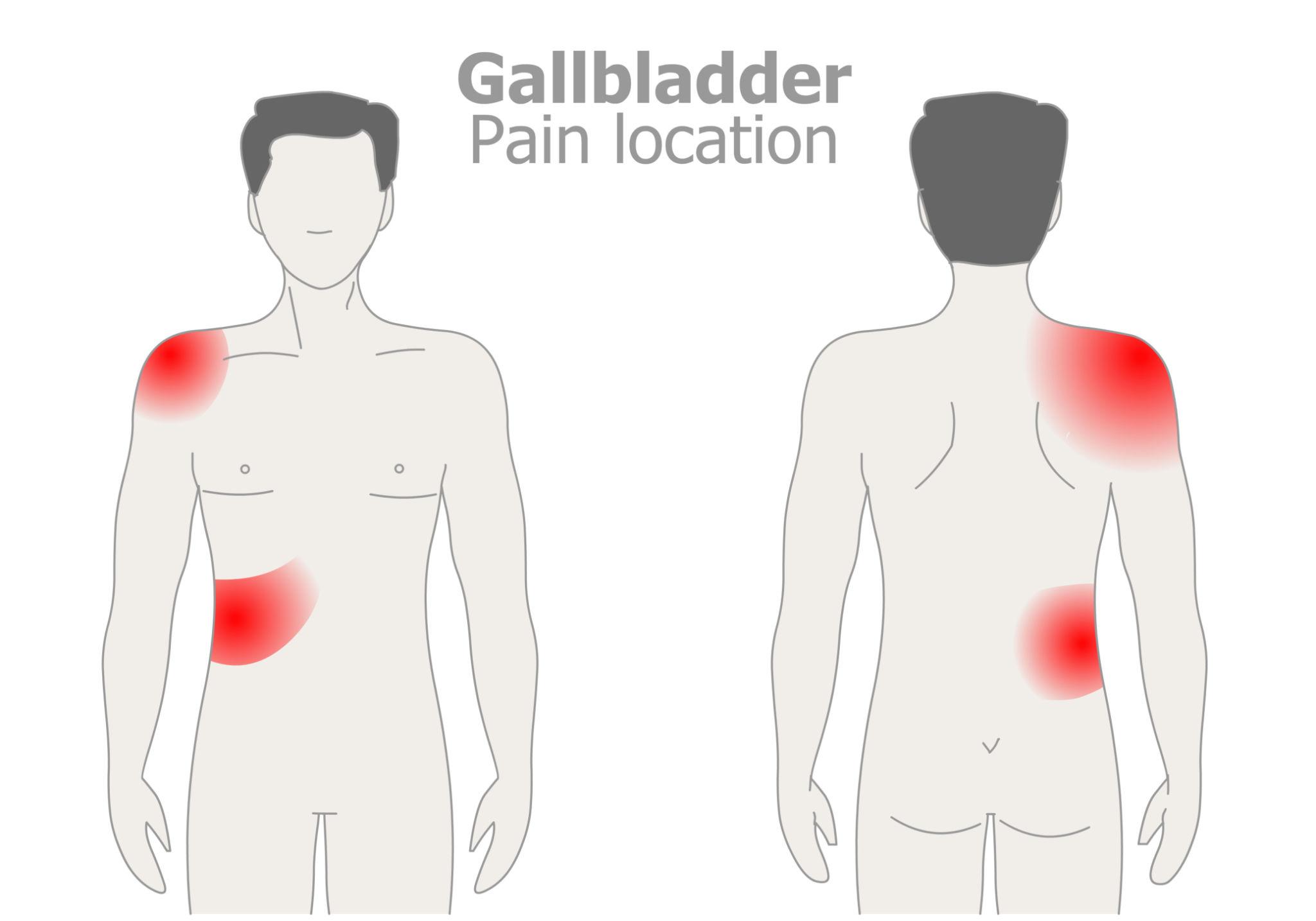 Gallbladder Stone Pain Area