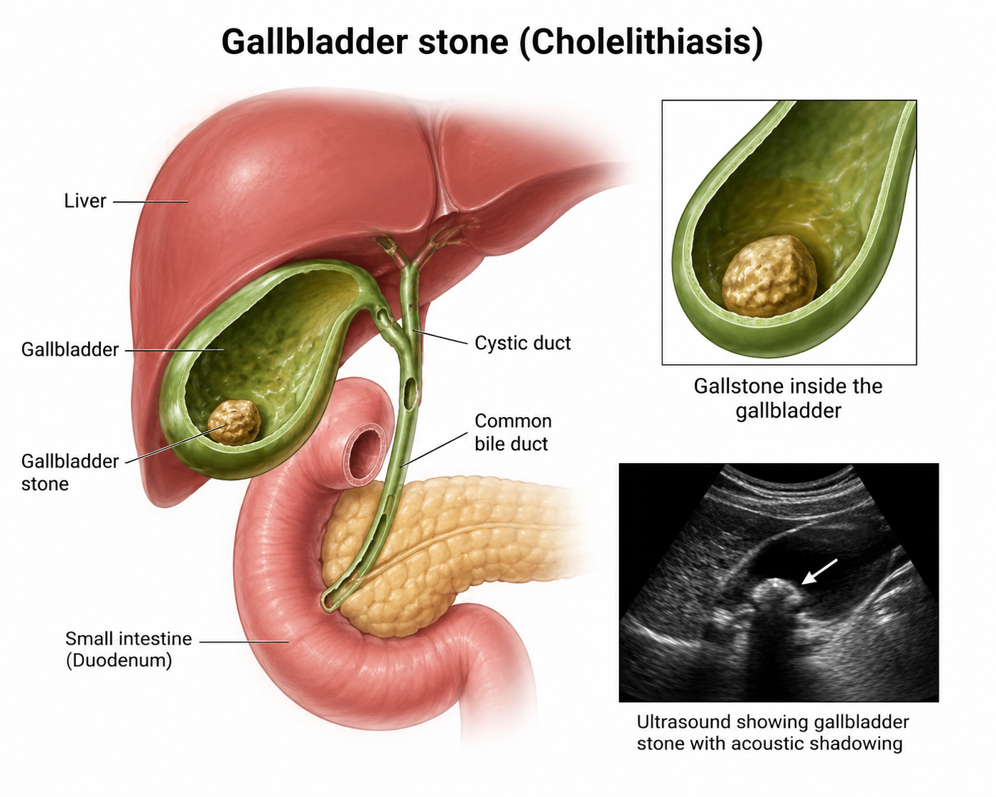 Gallbladder Icon